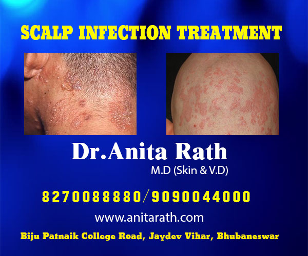 Best skin infection treatment clinic in bhubaneswar near me